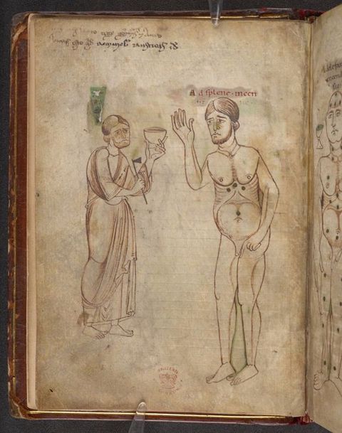 Illumination. A nude man’s body is marked with four dots—one over his belly button and the other three in a triangle at the top of his abdomen under his pectoral muscles. He holds up one hand, and his brows are knit together. A man wearing a robe stands to our left with a bowl and blade-like instrument at the ready.